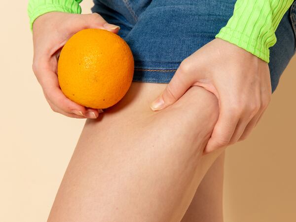 Adiós a la celulitis de las piernas y glúteos: 4 tips para acabar con ellas
