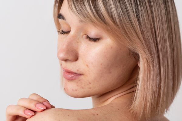 5 señales de que tienes la piel deshidratada y está pidiendo ayuda a gritos