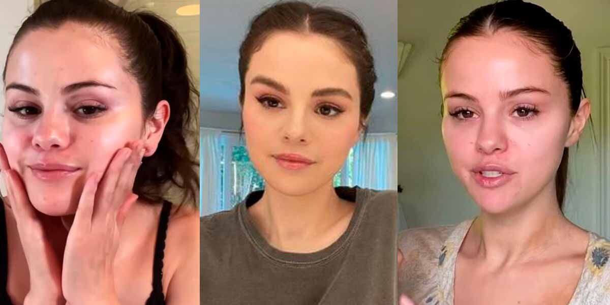 Selena Gomez se muestra sin maquillaje y deja ver el acné en su rostro Selena Gomez se muestra sin maquillaje y deja ver el acné en su rostro