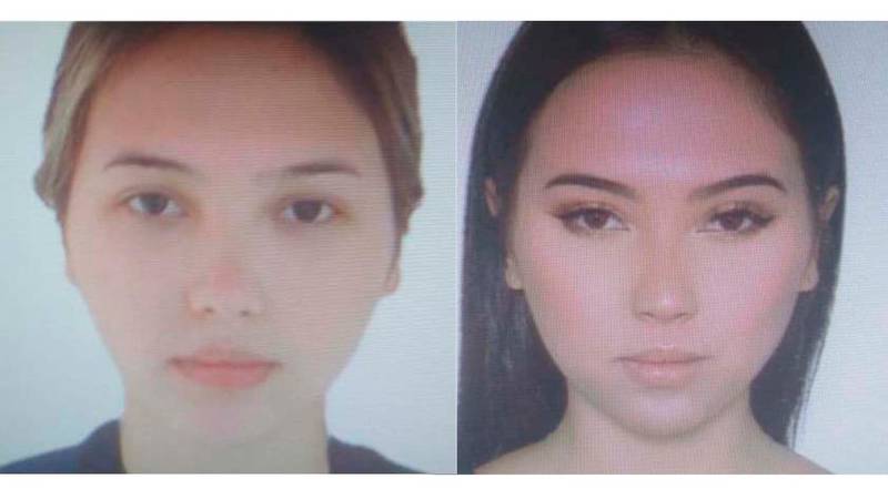 Antes y después de Aida Victoria Merlano