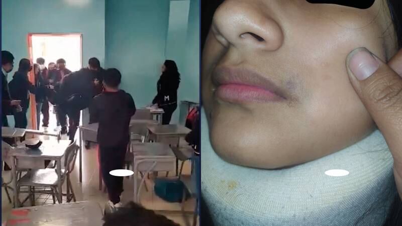 Madre denuncia que su hija es víctima de bullying en un colegio de Quito y muestra fotos de la menor brutalmente golpeada