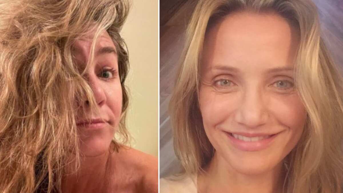 Estas famosas expresaron su rechazo al bótox