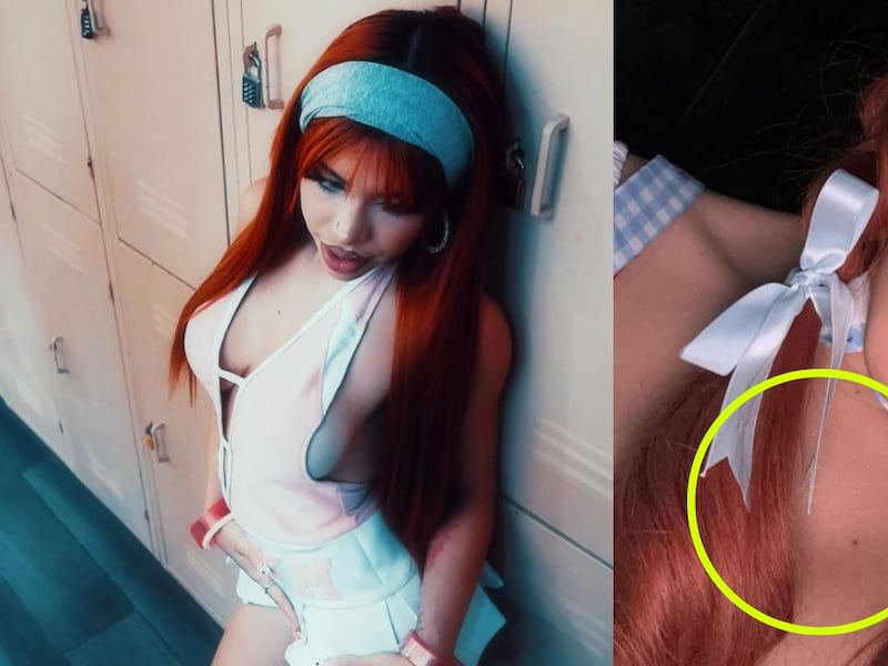 Yeri Mua confiesa tener terrible enfermedad en la piel ¿Es viruela del mono?