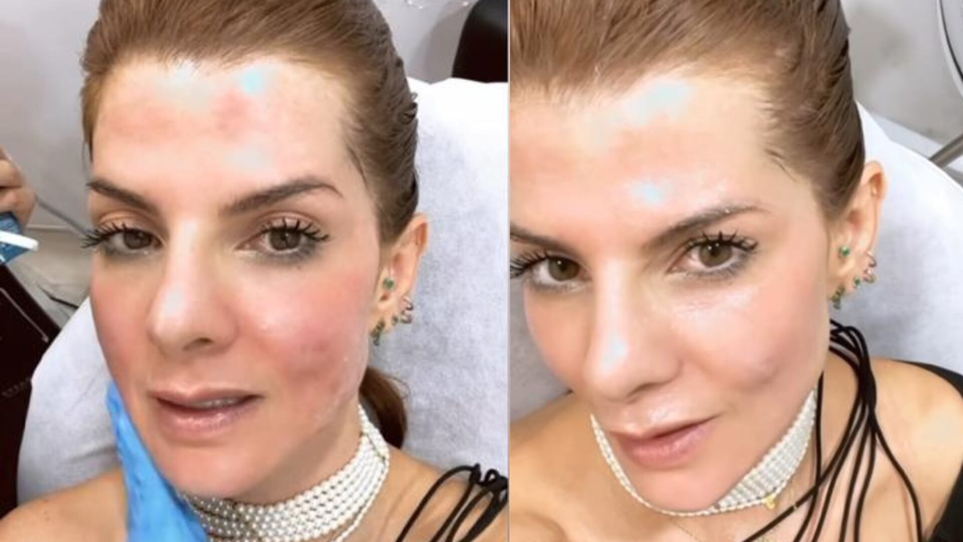 Carolina Cruz mostró el doloroso procedimiento estético al que se somete