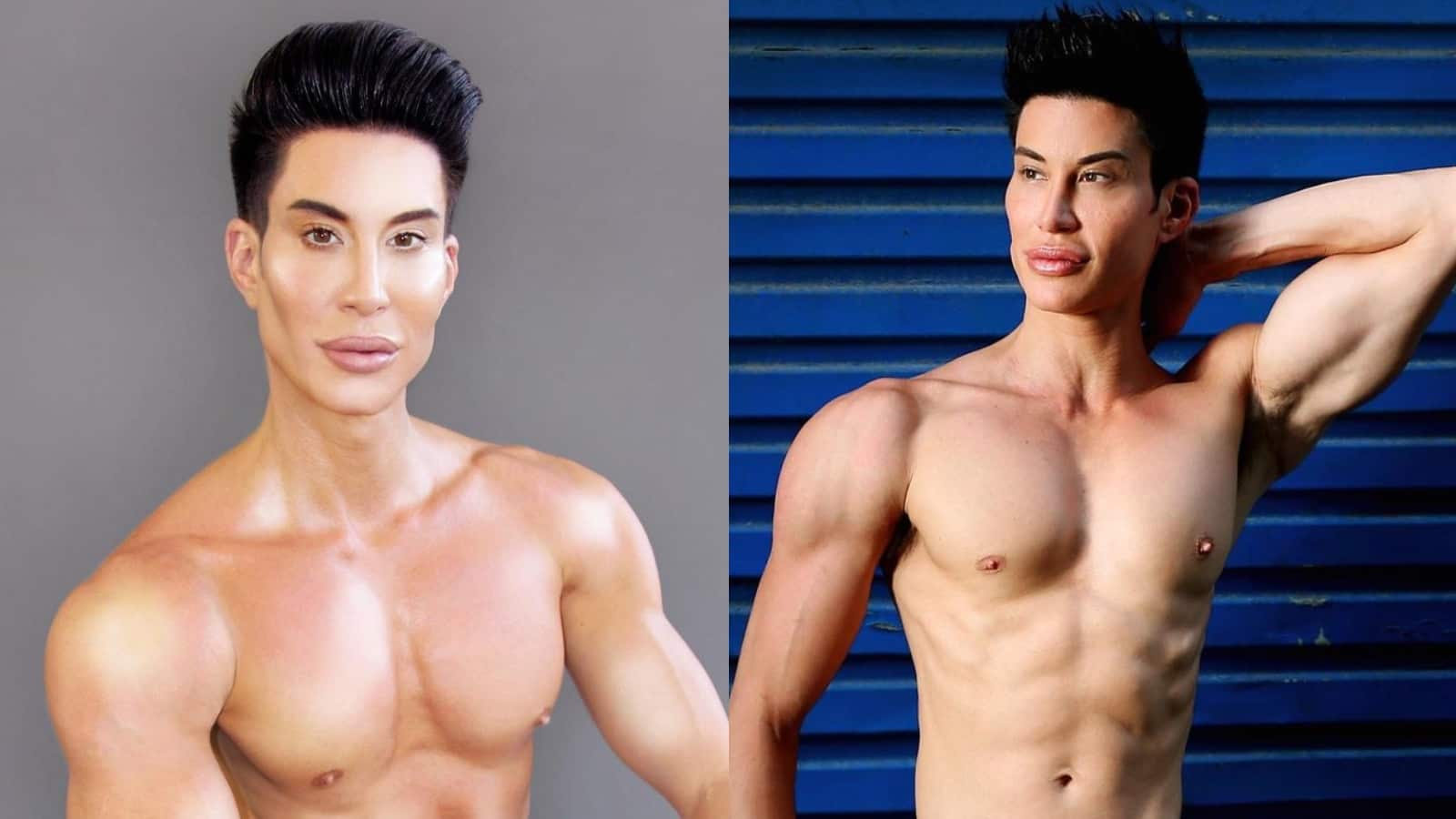 ken humano cirugía de piernas