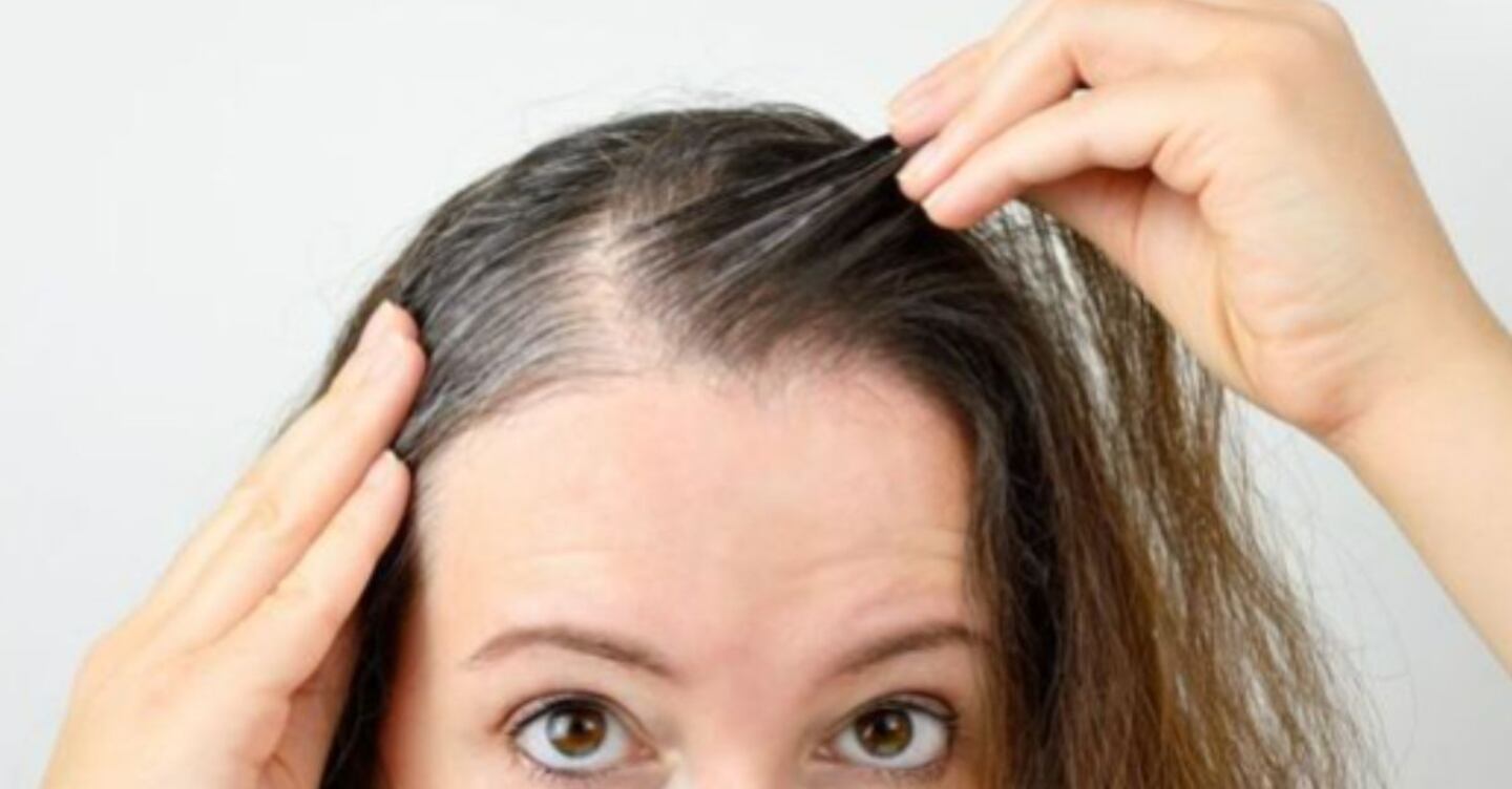 Como Evitar Que Las Canas Se Pongan Amarillas www.nuevamujer.com