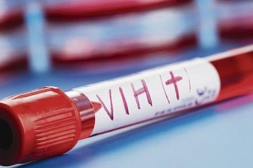 Estadounidense, tercera persona y primera mujer posiblemente curada de VIH
