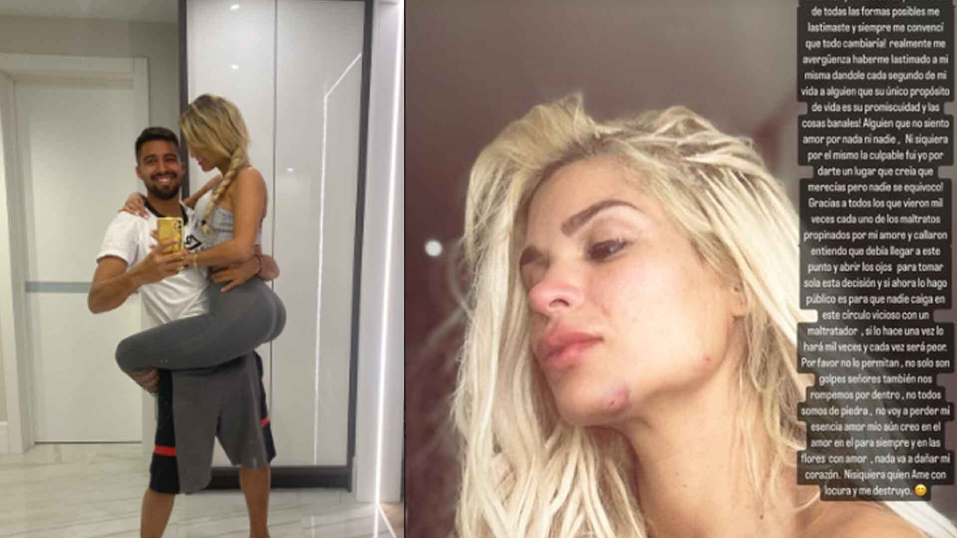 Keviam Cazo denuncia a Christian Noboa por agresión, en redes sociales.