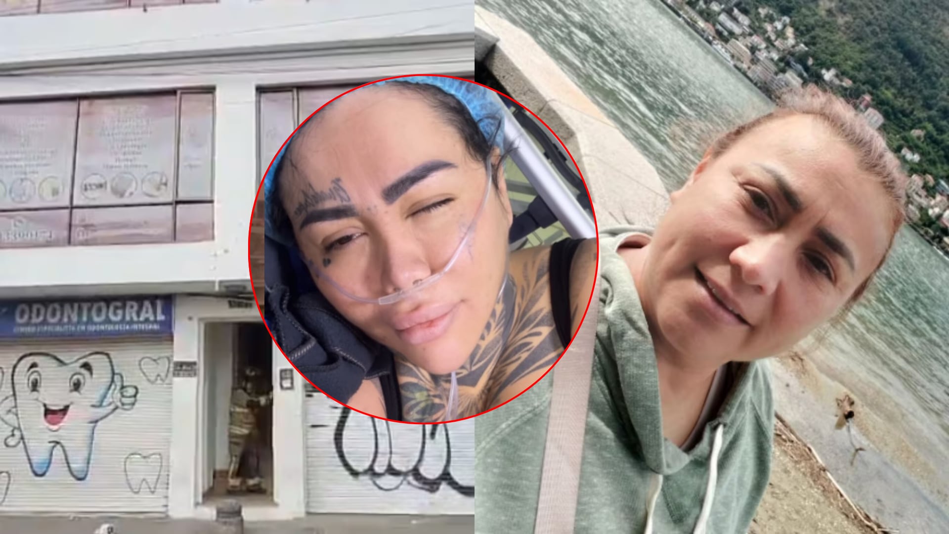 Caso de Yuliza Toloza revive polémicas por cirujanos de Yina Calderón