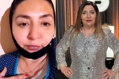 “Me hice un merequetengue”: Pincoya reveló que se sometió a un nuevo procedimiento estético en su rostro