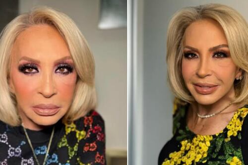 Laura Bozzo le hace la guerra a las arrugas: “Necesito quitarme la cara de momia”