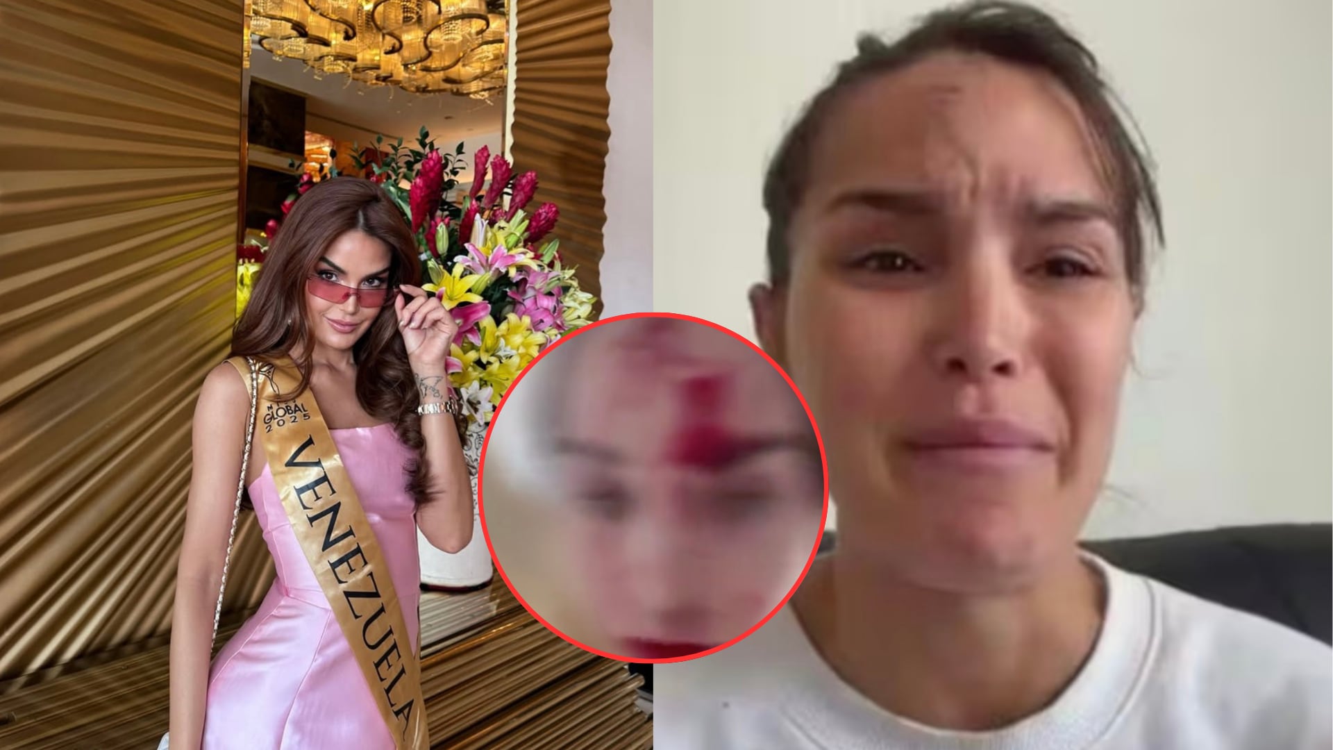 Miss Venezuela agredida en Cannes