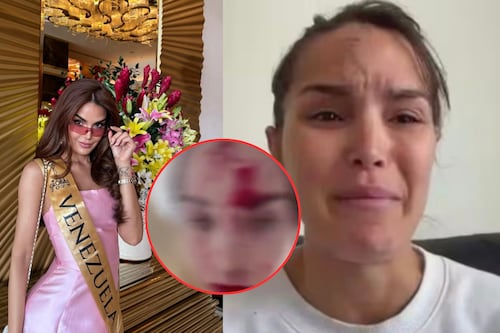 Las impactantes imágenes de la agresión que sufrió Miss Venezuela por parte de su estilista en Cannes