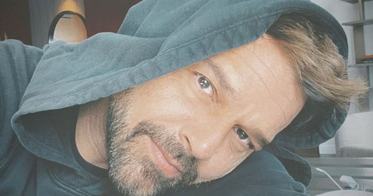 Ricky Martin sufre un problema en el rostro y revelan su truco para ...