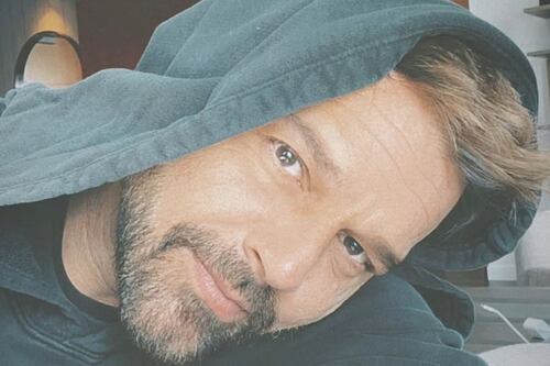Ricky Martin sufre un problema en el rostro y revelan su truco para verse guapo