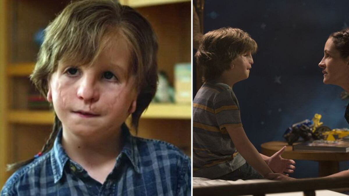 Así luce el niño de ‘Wonder’ a sus 16 años que triunfa como modelo