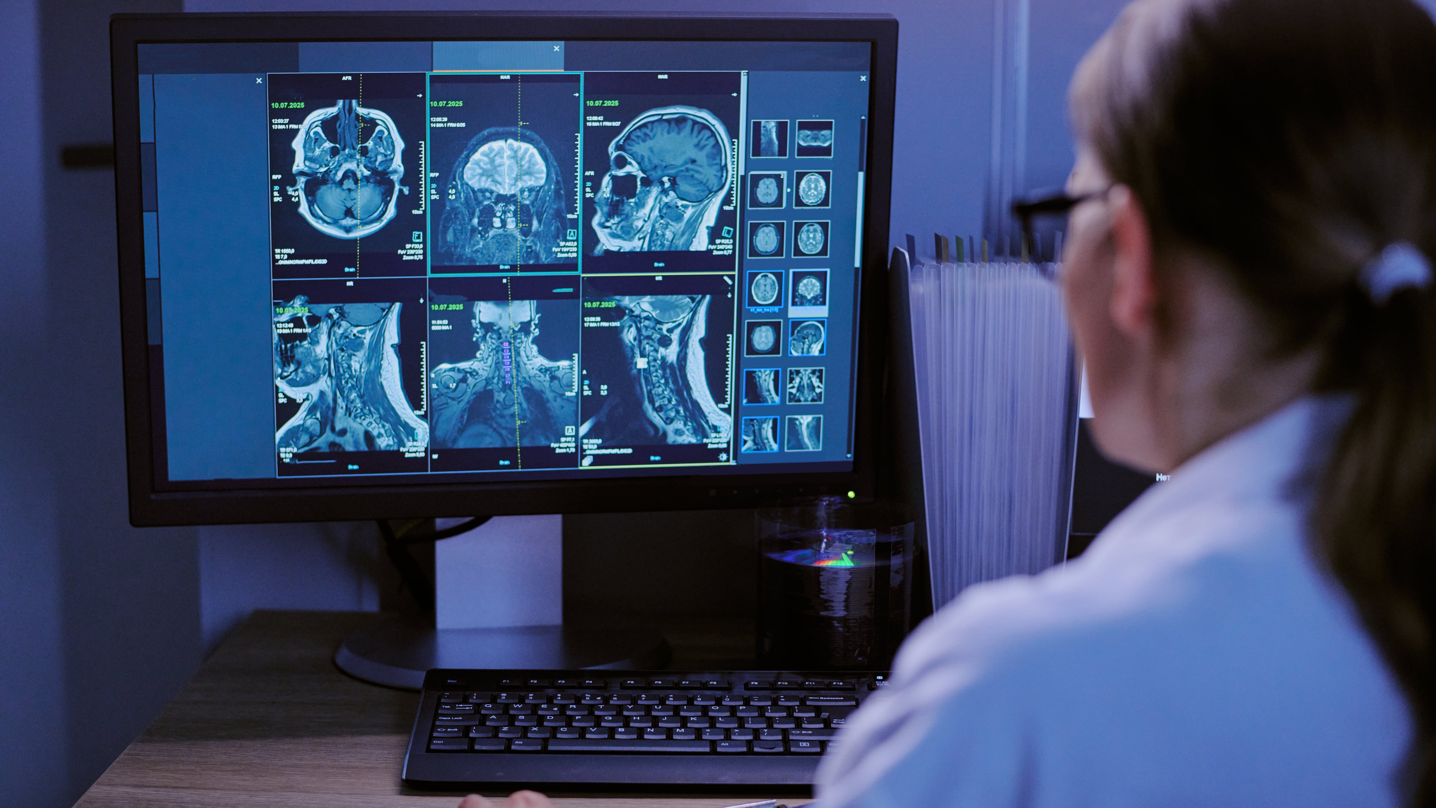 Así afecta la violencia de género al cerebro de las mujeres
