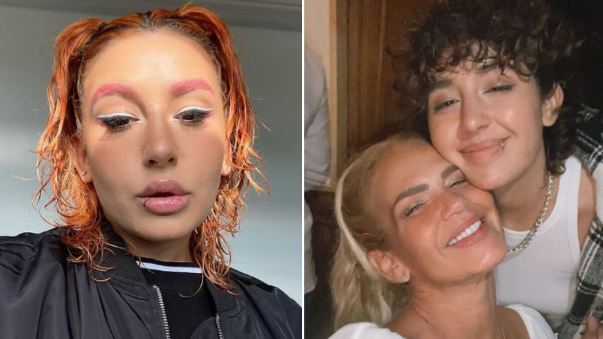 ¿Qué es el herpes zoster? Romina Marcos reveló padecer esta condición debido a estrés y ansiedad