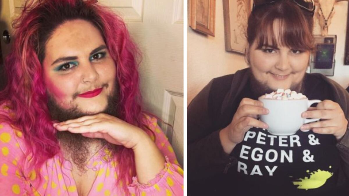 Mujer presume su barba y nos enseña a amarnos como somos