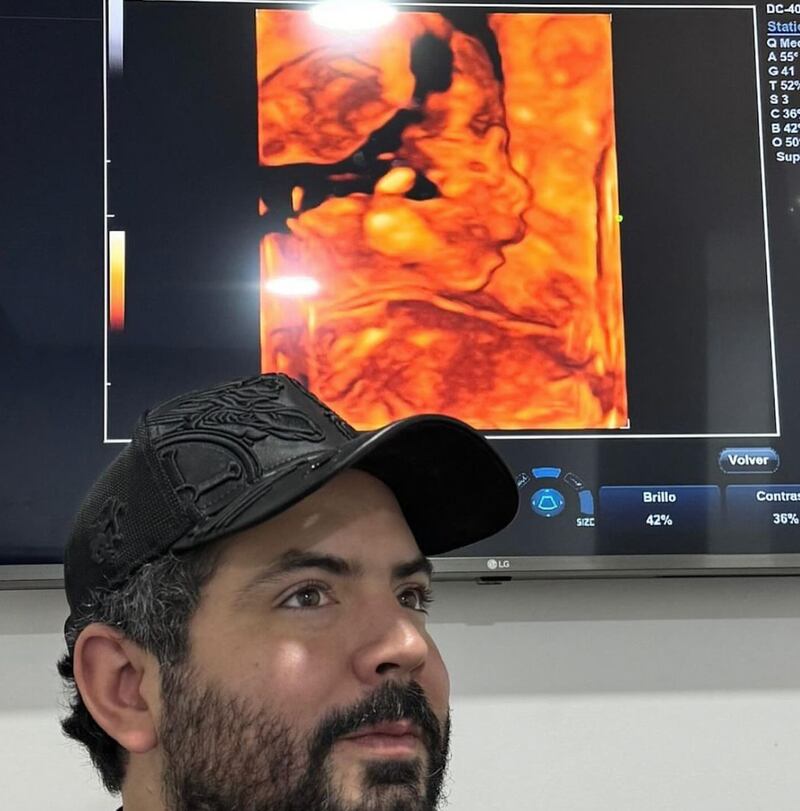 José Eduardo Derbez