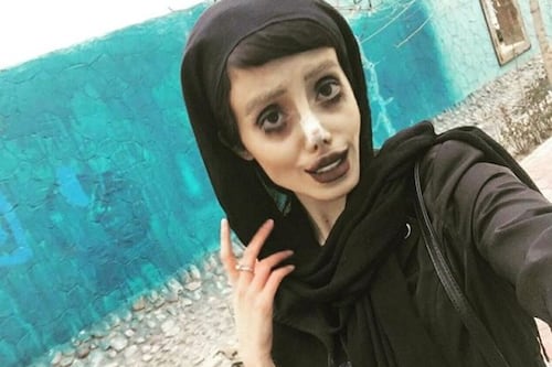 Conectada a ventilador mecánico: estrella de Instagram ‘Angelina Jolie Zombie’ está grave tras contraer coronavirus en cárcel iraní