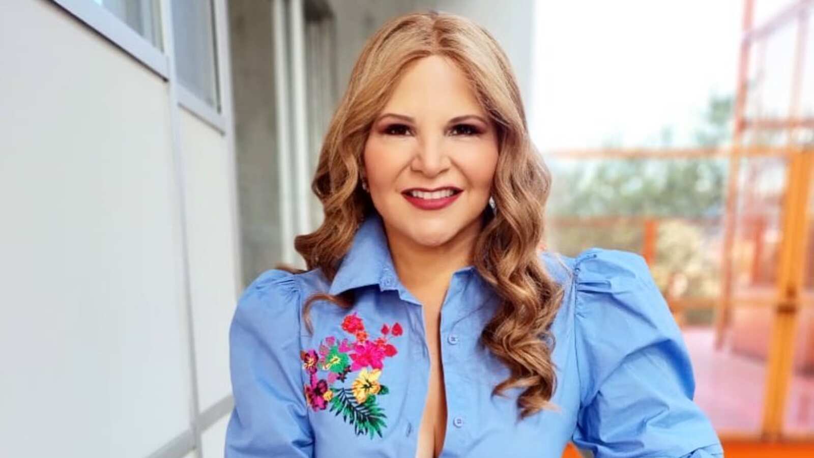 Las críticas a Diva Jessurum por sus fotos con exceso de botox