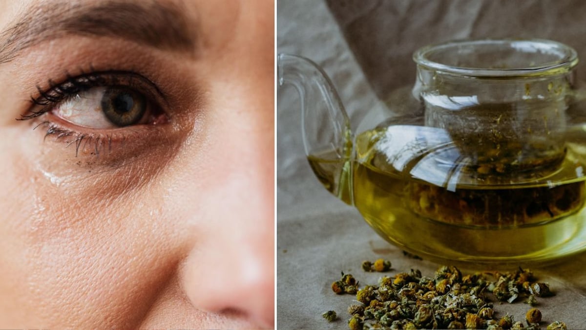 La manzanilla cuenta con propiedades ideales para combatir las bolsas en los ojos