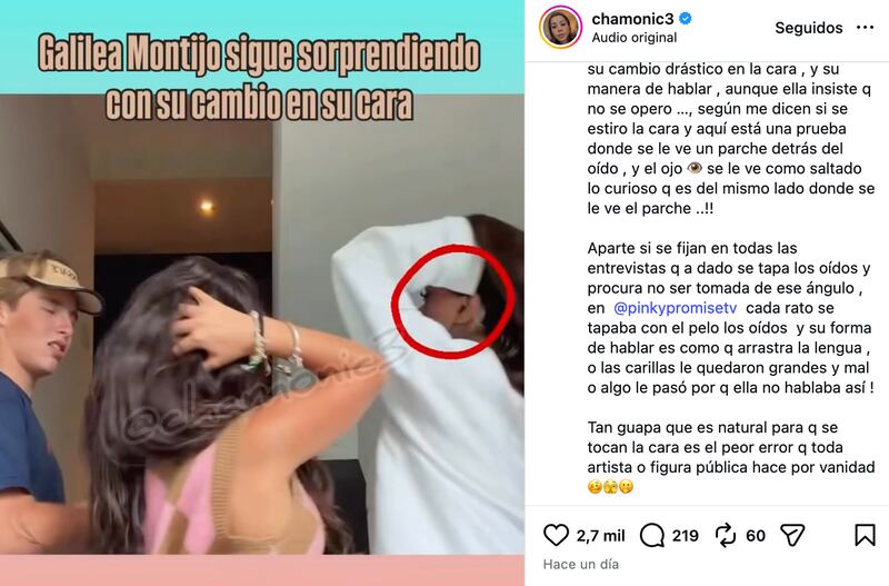 Chamonic muestra "cicatriz" en el rostro de Galilea Montijo