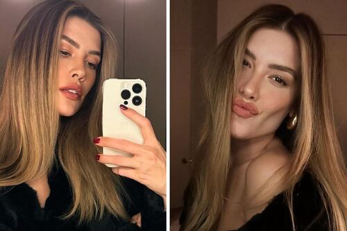 Michelle Salas revela que sufre de un trastorno y les pide ayuda a sus seguidores