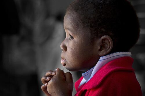 Niño africano deslumbra con sus grandes ojos azules y marca en forma de rayo: es por una enfermedad