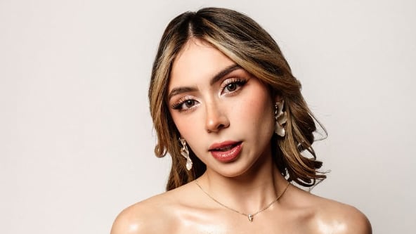 Así era antes de su operación Karen Torres.