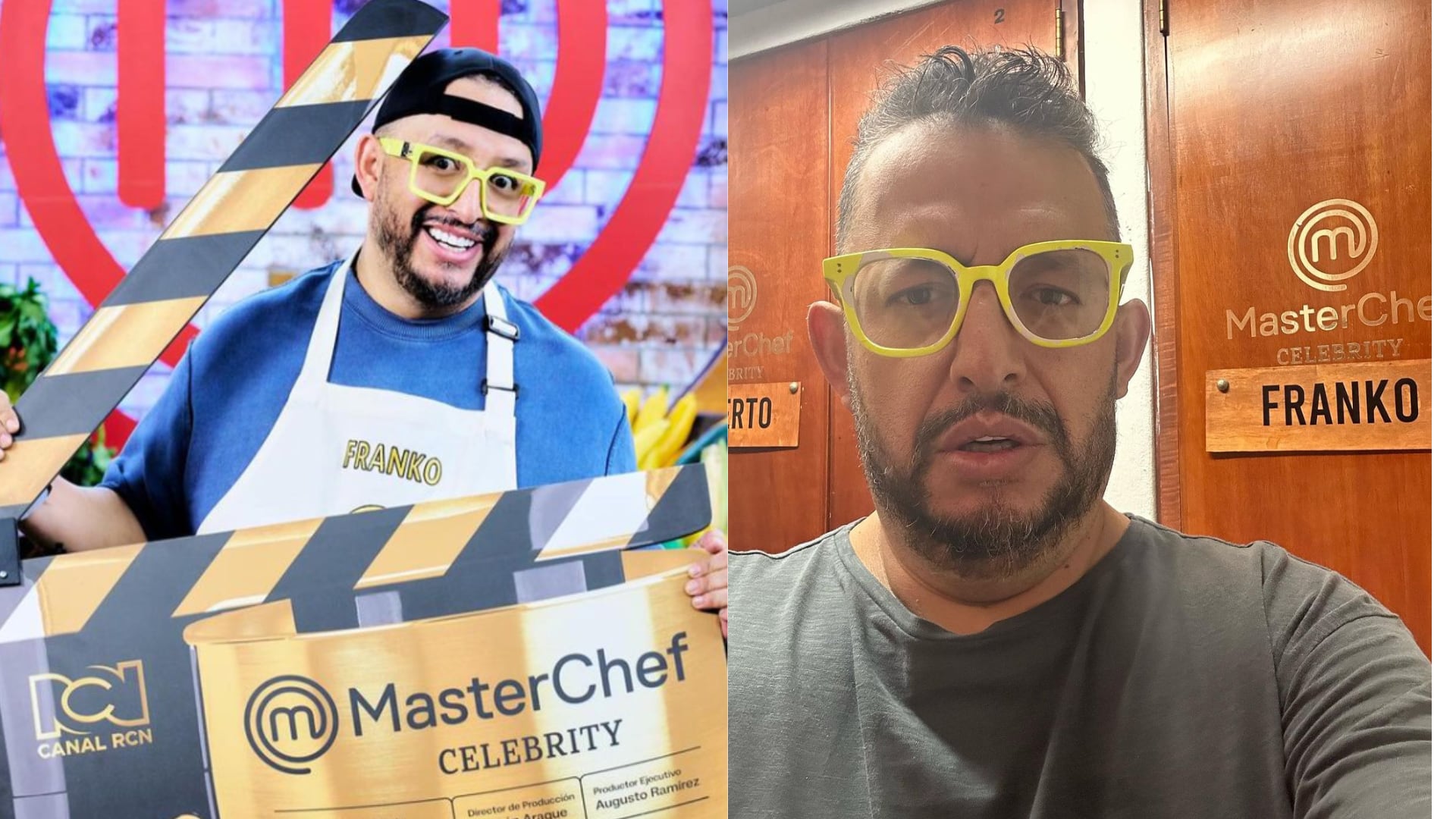 Franko Bonilla de MasterChef se sometió a delicada cirugía