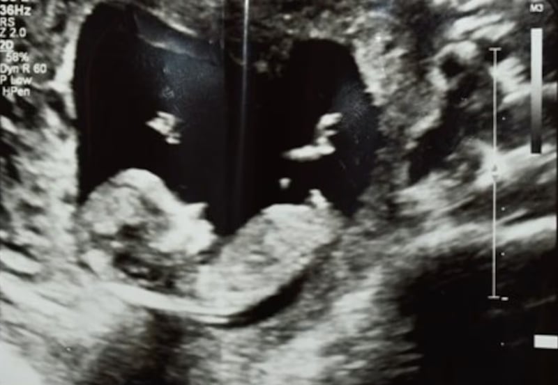 Donovan Faison fue declarado culpable de asesinar a su novia embarazada tras negarse a abortar; enfrenta la pena de muerte en Florida.