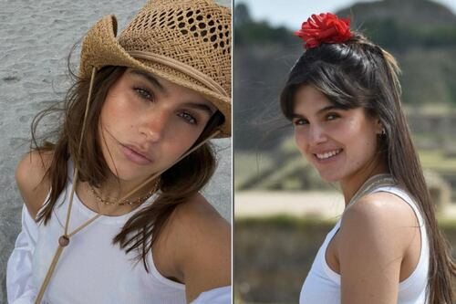 ¿Qué es la dermatitis seborreica? El padecimiento que sufre Romina Poza hija de Mayrim Villanueva y Jorge Poza