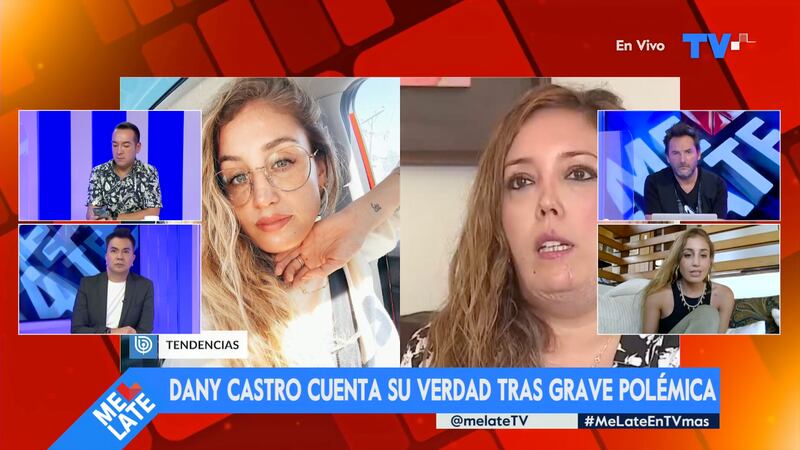Dani Castro se refirió al accidente que sufrió Carolina Mujica al ser mordida por su perro Charlie