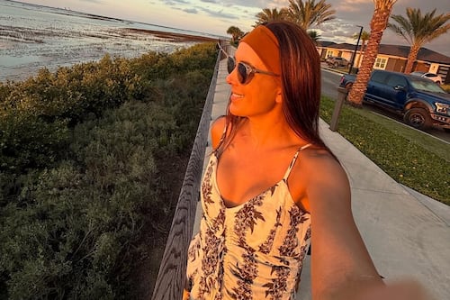 La Flaca Guerrero visibiliza el duelo por la pérdida del cabello: “No nos definen ni el pelo ni las cicatrices”