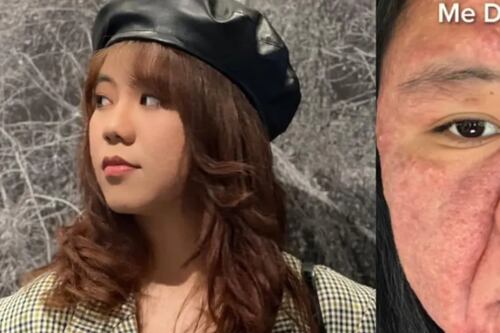 El impactante cambio físico en su rostro que tuvo una mujer durante y después de su embarazo