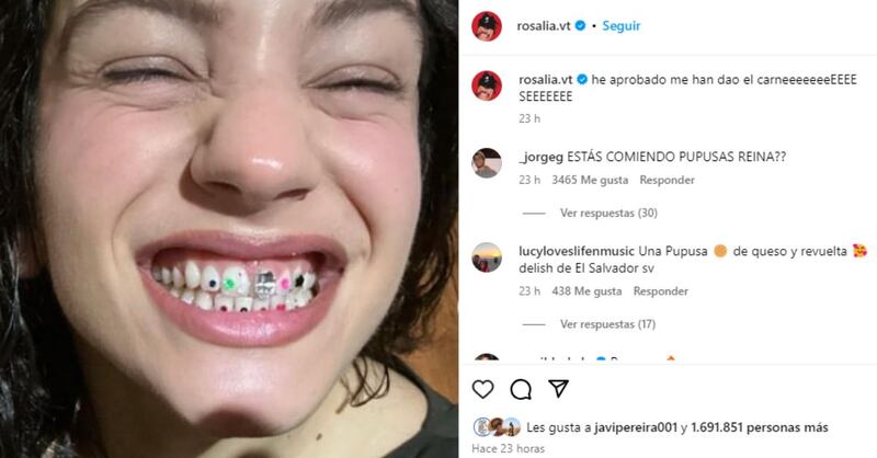 “Esto se va a descontrolar”: La arriesgada y sorprendente tendencia que adoptó la dentadura de Rosalía, ¿la intentarías?