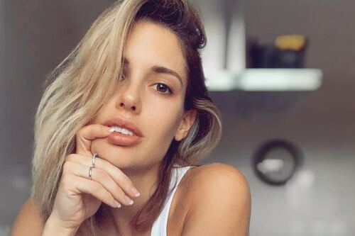 Gala Caldirola muestra los moretones en sus labios por tratamiento para disolver el ácido hialurónico