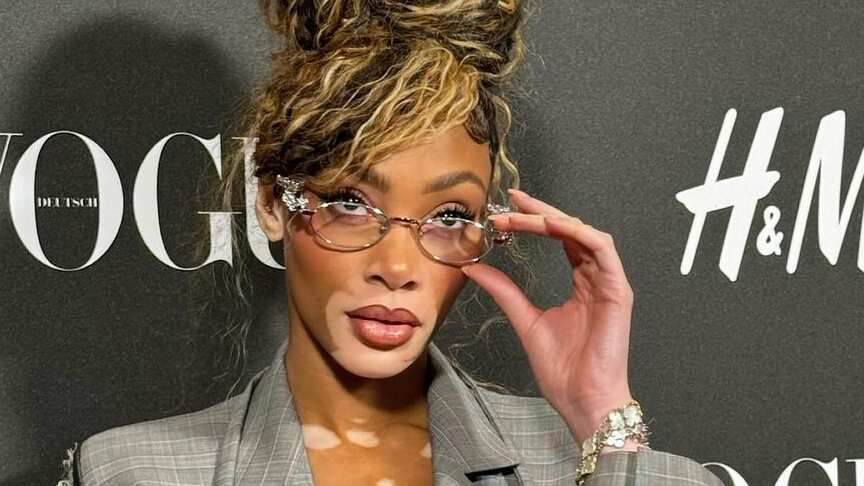 Winnie Harlow, modelo