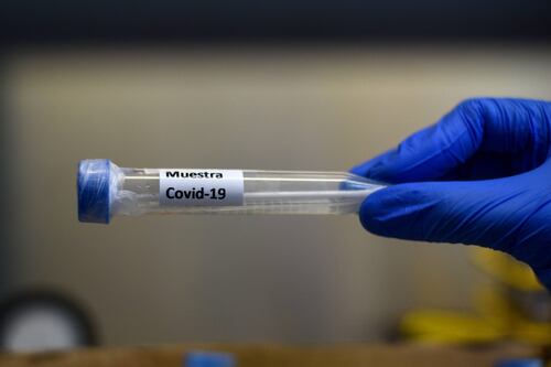 Investigadores chilenos lideran desarrollo de vacuna contra el coronavirus