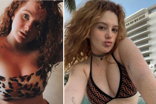 Qué es la luxación de costillas, la polémica operación que se hizo Briggitte Bozzo para estilizar su figura