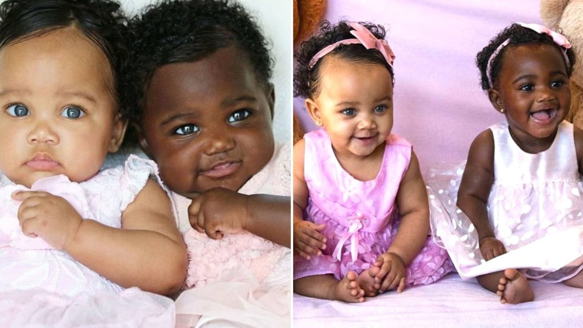 Isabella y Gabriella Shipley son los nombres de las gemelas con diferente color de piel |