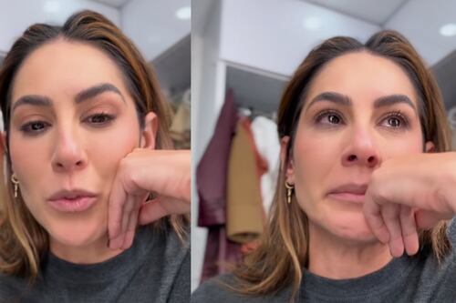 Carolina Soto de ‘Día a Día’ mostró el tratamiento al que se sometió para combatir la alopecia