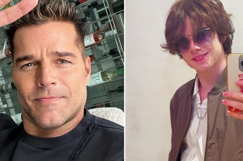 Hijo de Ricky Martin preocupa por su salud y comparte alarmante fotografía ¿Qué le pasó?