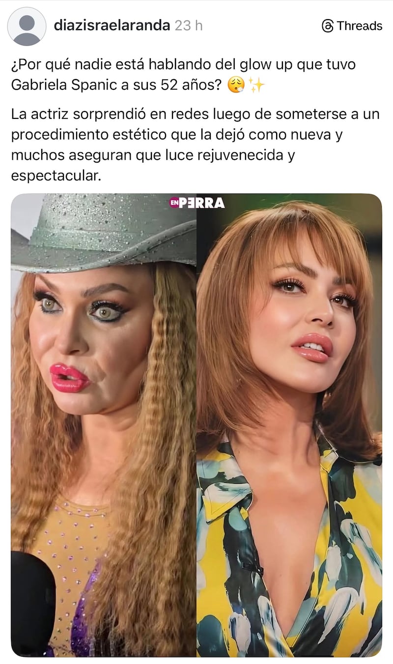 “La dejaron como nueva”: rostro de Gaby Spanic impacta a sus 52, aseguran luce radiante y rejuvenecida