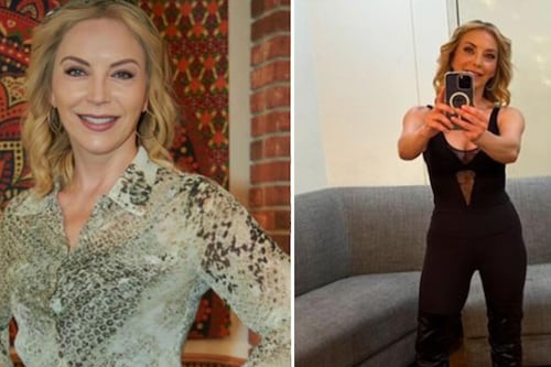 Laura Flores comparte su mala experiencia con el procedimiento estético de hilos tensores