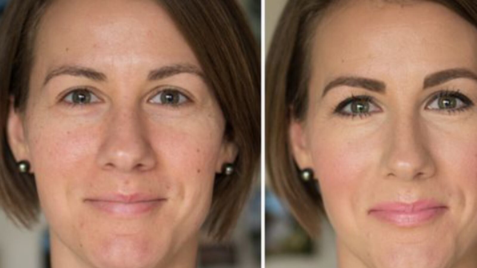 Trucos para elevar el párpado caído