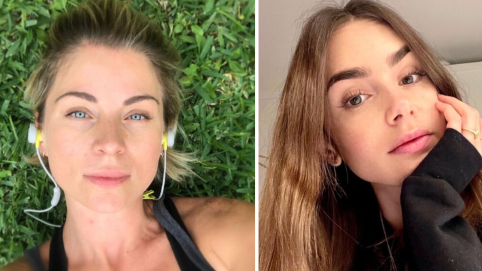 Famosas con manchas en el rostro