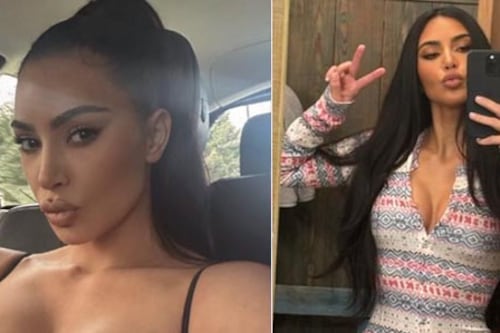 Kim Kardashian enfrenta duro diagnóstico sobre su cerebro y enciende alertas para que mujeres no pasen por lo mismo